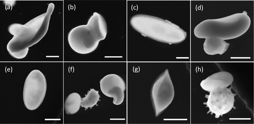 Image of SE fungal spores